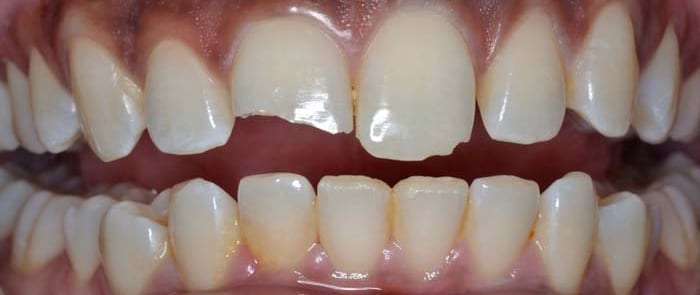 Before and After Dentistry Photos
